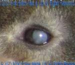 This is a fairly severe case of cataracts.